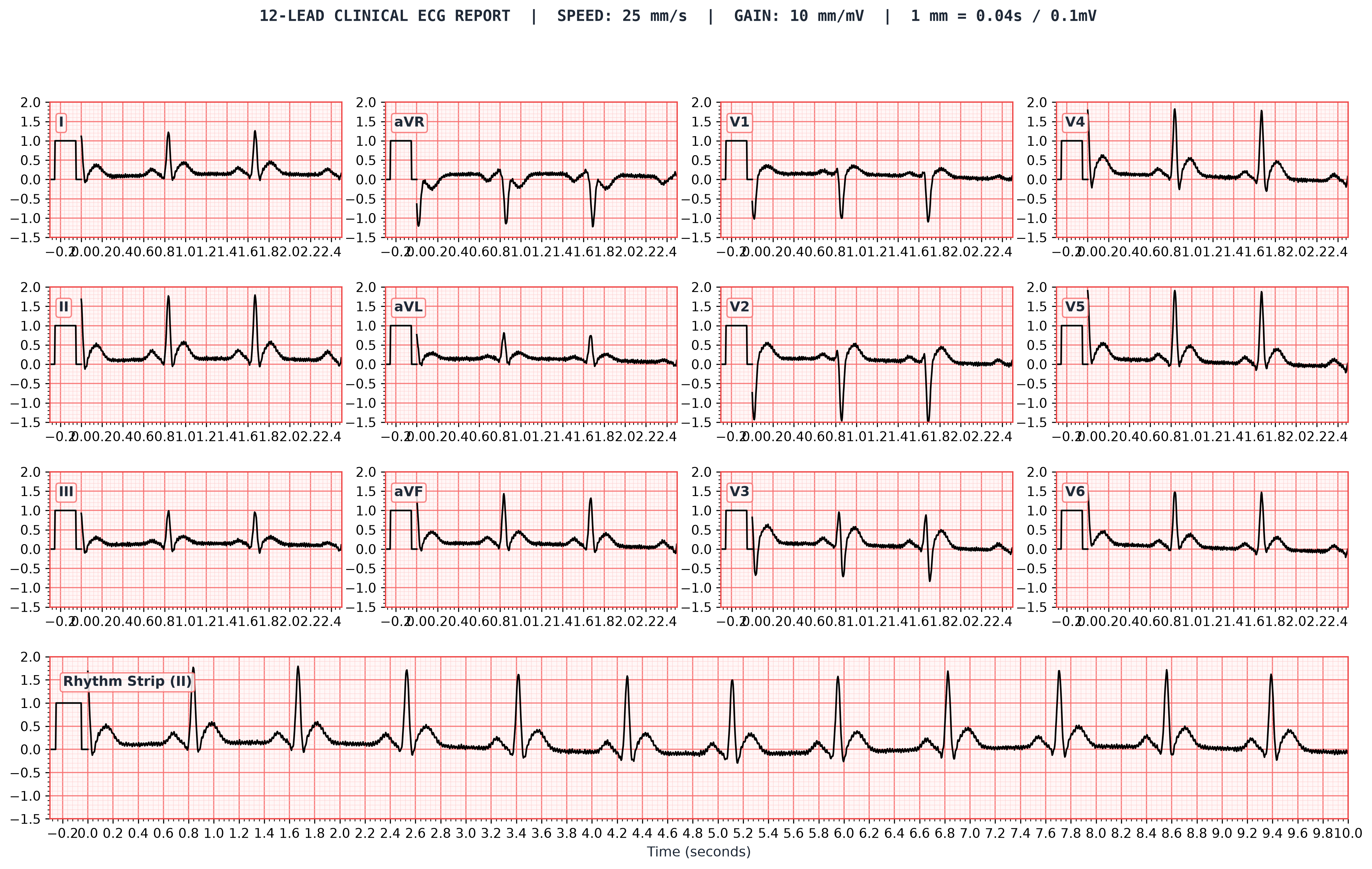 12-Lead Clinical ECG Report