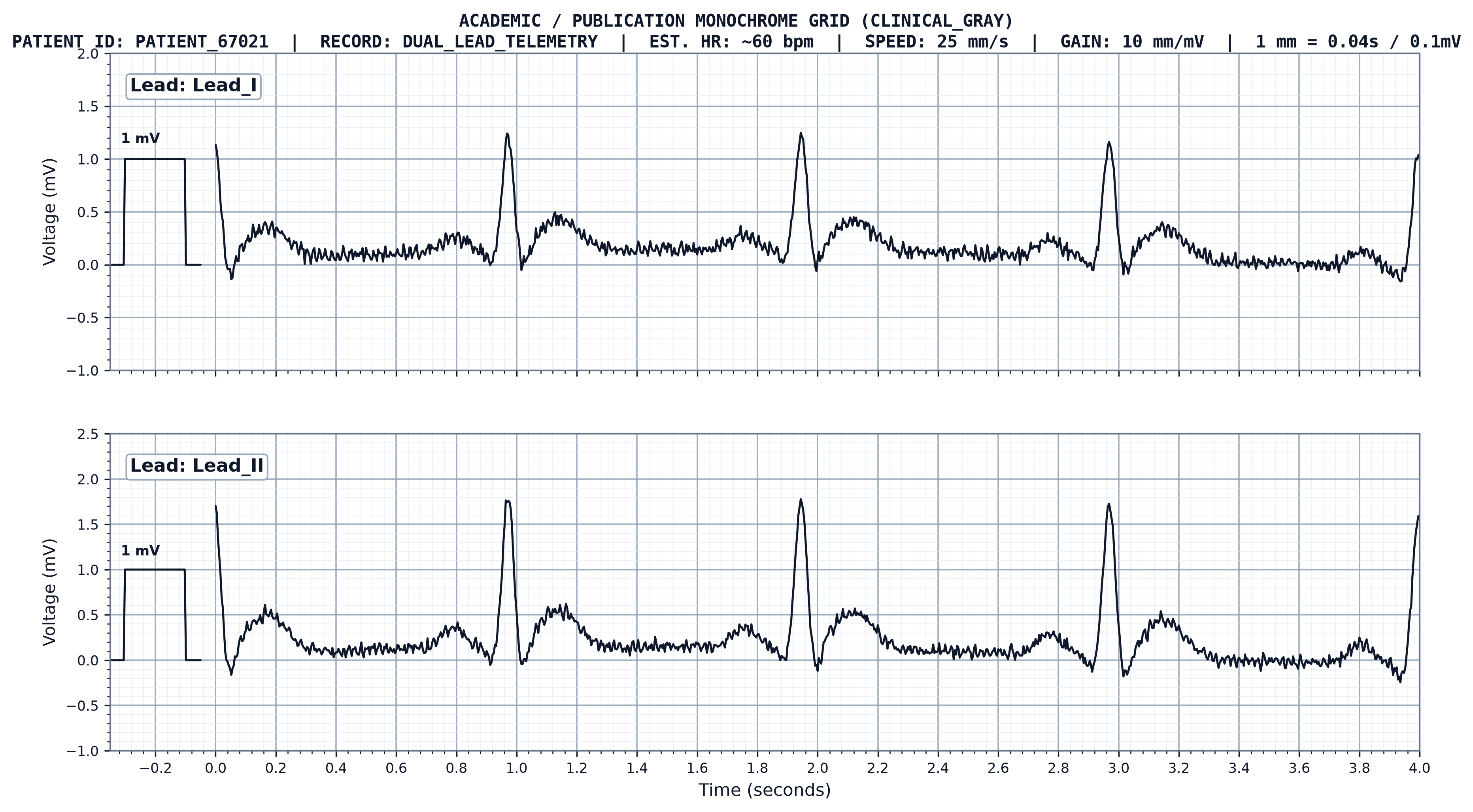 Clinical Gray ECG Paper Strip