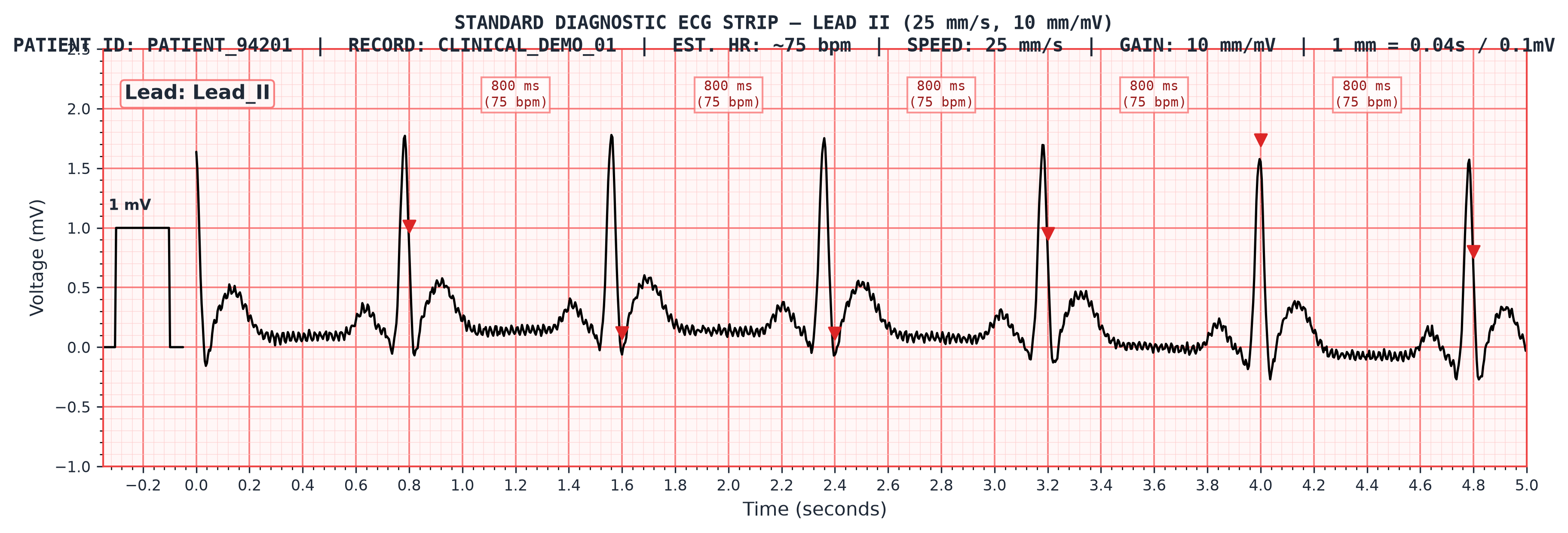 Rendered Clinical ECG Strip