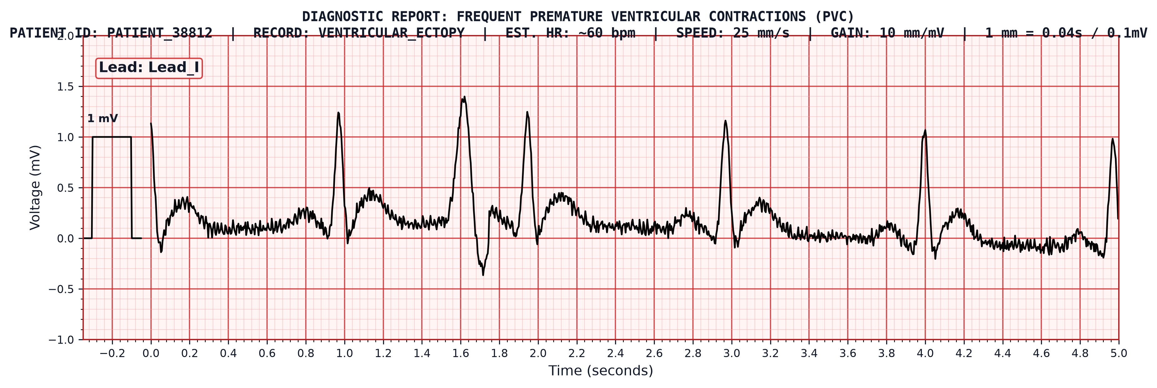 Clinical Red ECG Paper Strip